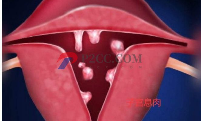 排卵期性腹痛和出血是怎么回事，需不需要治療？(圖2)