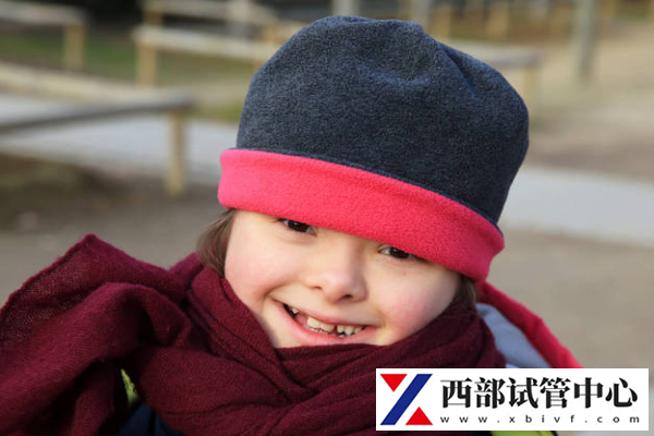 唐氏綜合癥風(fēng)險(xiǎn)度如何看
